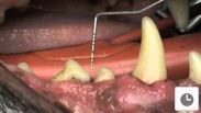 video clip of dental examination